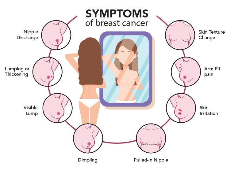 Top Alarming Symptoms of Breast Cancer