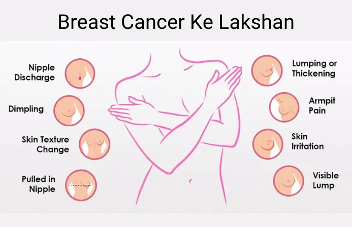 Breast Cancer Ke Lakshan 