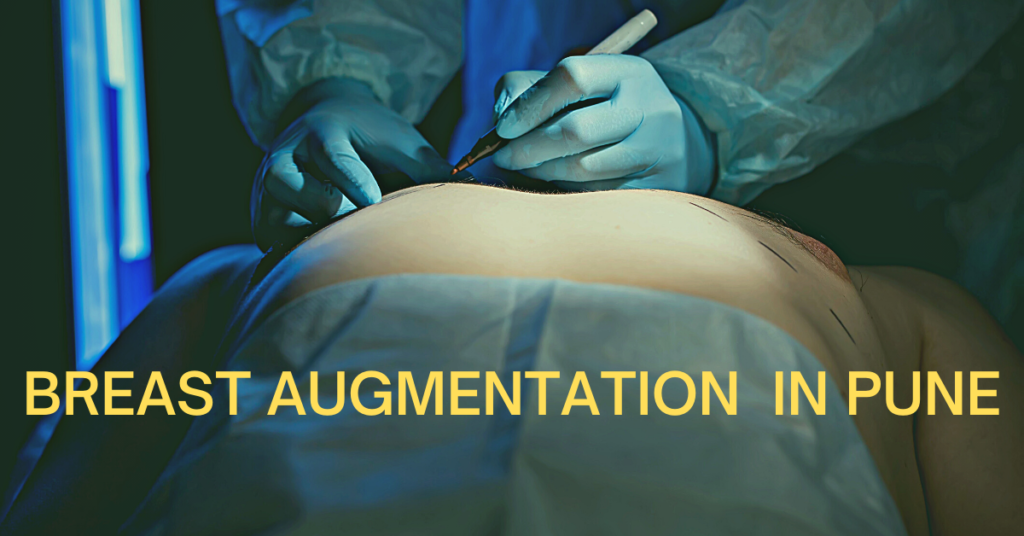 BREAST AUGMENTATION IN PUNE