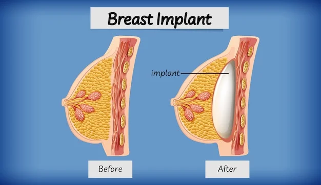 Breast Augmentation Mastopexy